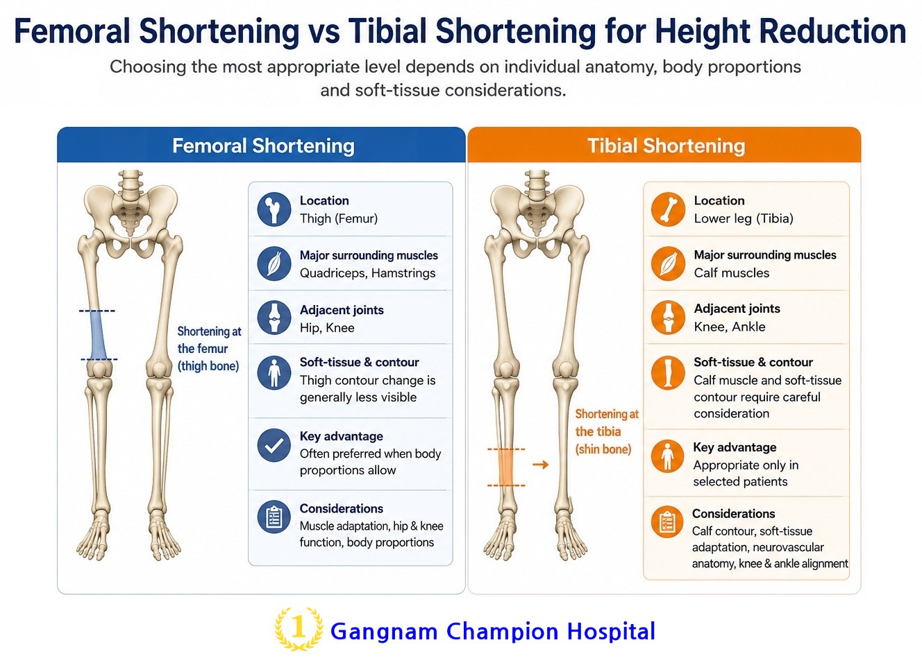 Comparison of femoral shortening and tibial shortening for height reduction surgery
